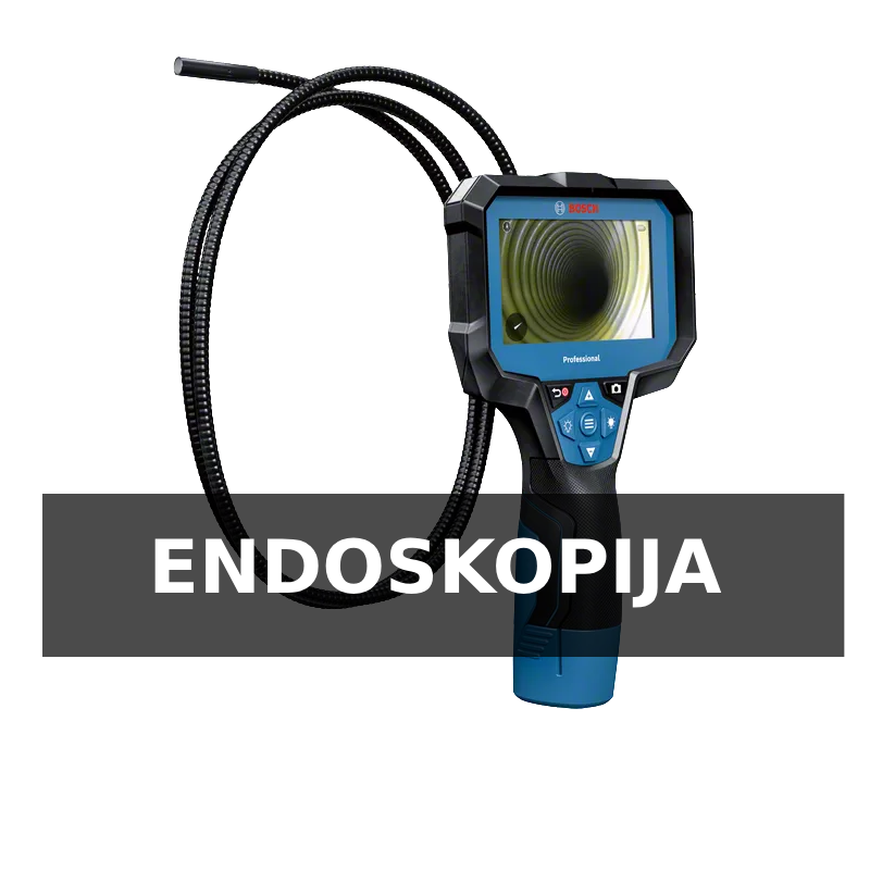 endoskopija beograd snimanje endoskop kamerom beograd endoscope sonda snimanje detekcija